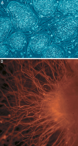 amniotic stem cell therapy for ankle arthritis