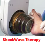 ESWT shockwave therapy