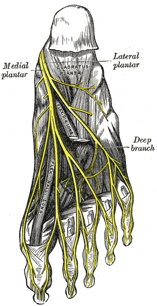 Morton's neuroma