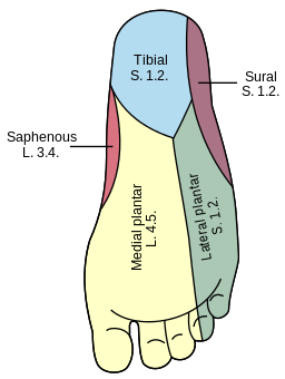 Morton's neuroma