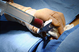regenerative medicine